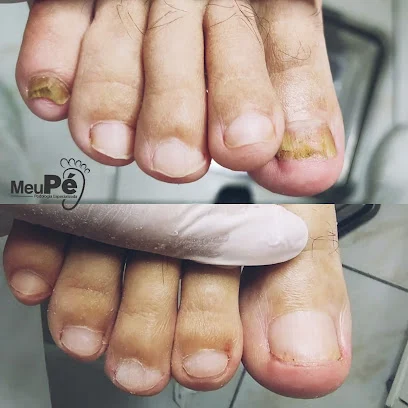 Clínica de Podologia especializada Meu Pé